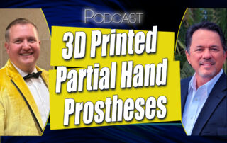 partial hand prosthetic design