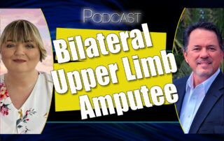 Double Upper Limb Amputee
