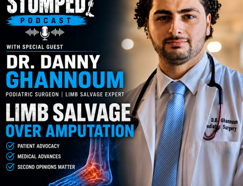 Limb Salvage vs. Amputation: When Is Saving the Limb Not the Best Outcome