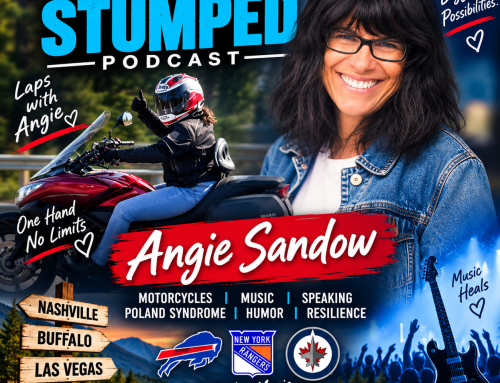 Angie Sandow: Poland Syndrome, Motorcycles, Music & Living With One Hand