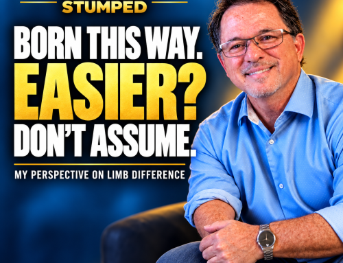 Born With a Limb Difference Doesn’t Always Mean We Have It Easier